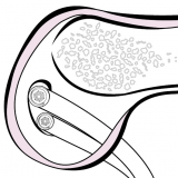 Double Bundle PCL Reconstruction
