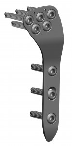 Condylar support plate