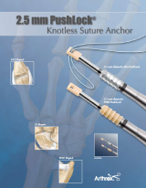 2.5 mm PushLock Knotless Suture Anchor