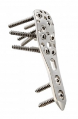 Proximal humerus plate