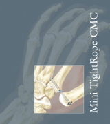 Mini TightRope CMC