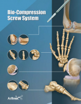 Bio-Compression Screw System