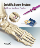 QuickFix Screw System