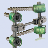 Spinal Fixation System